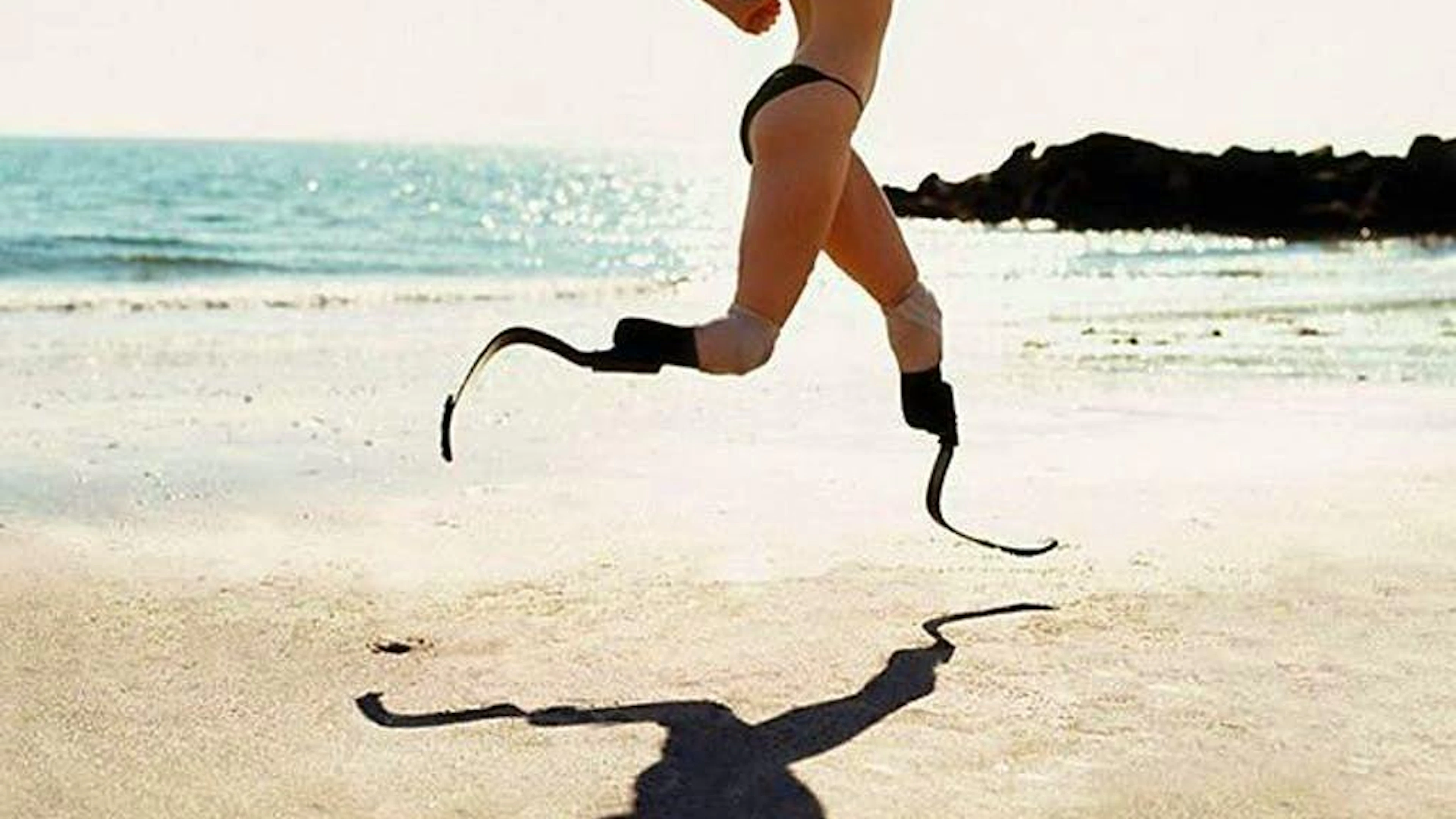 Aimee Mullins, die ohne Wadenbeine zur Welt kam, war paralympische Athletin und ist inzwischenn als Model und Schauspielerin tätig.