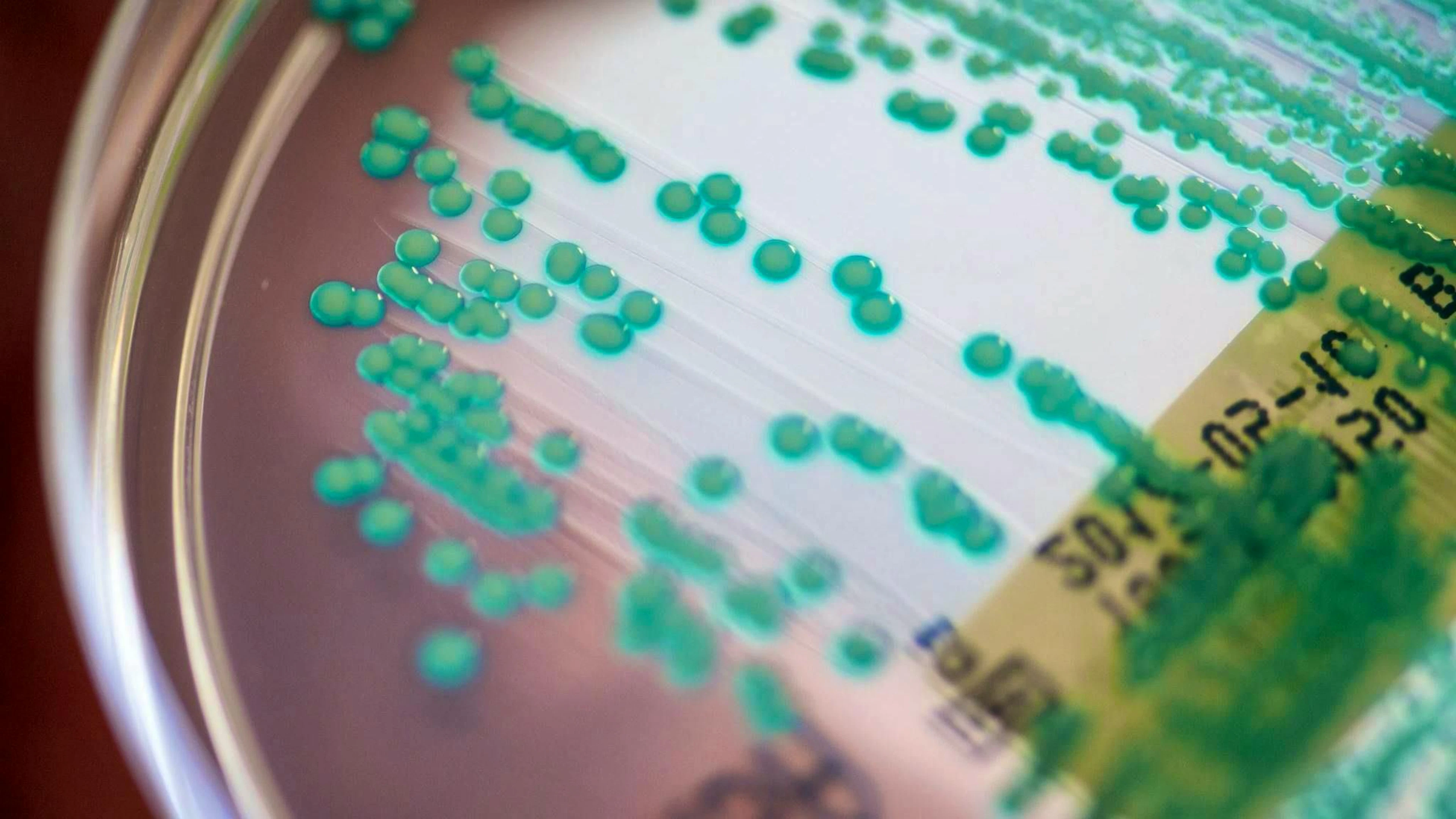 Una piastra di Petri con germi multiresistenti. (immagine d'archivio)