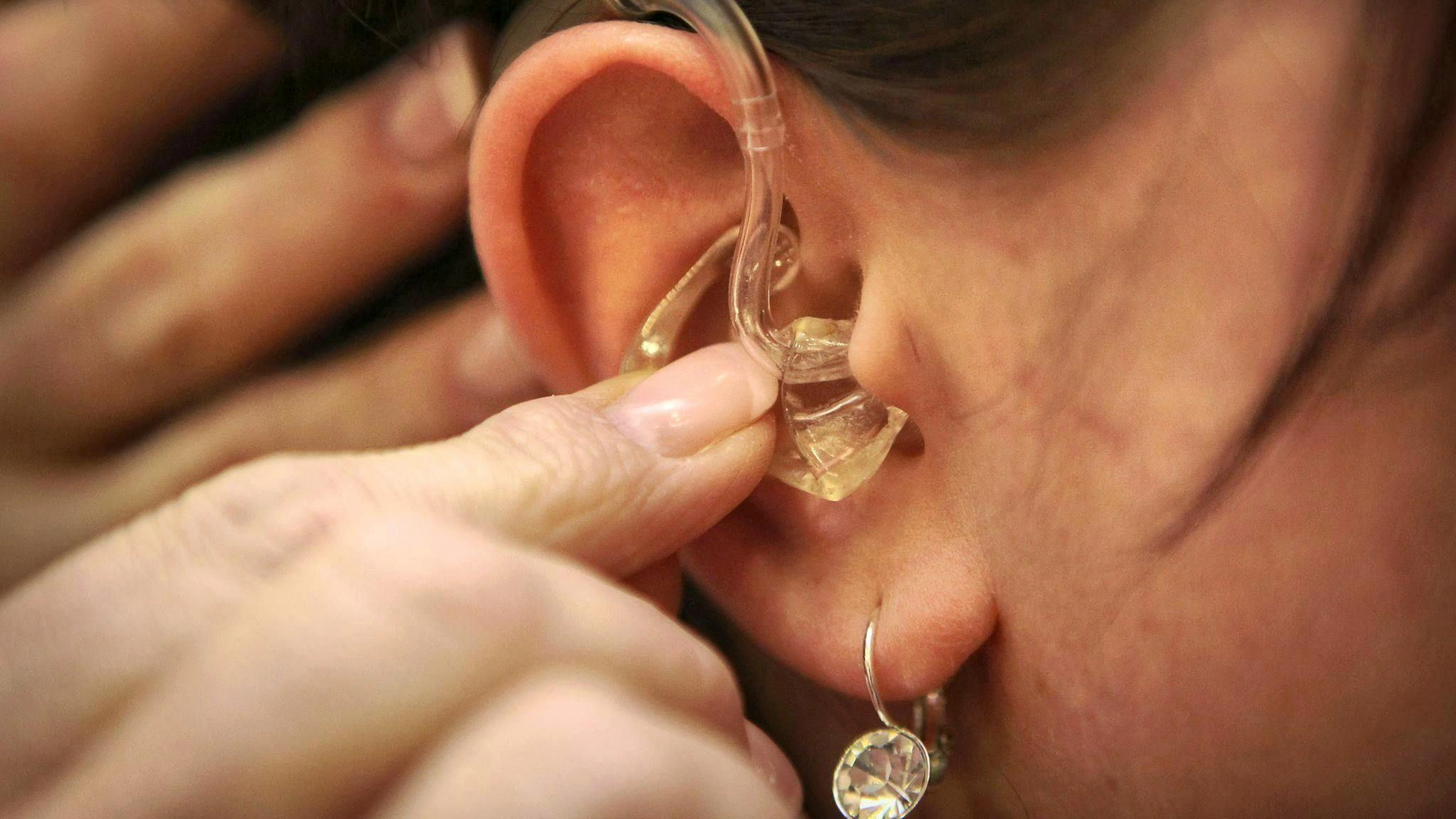 Hearing loss is the most important Alzheimer's risk factor in middle age.