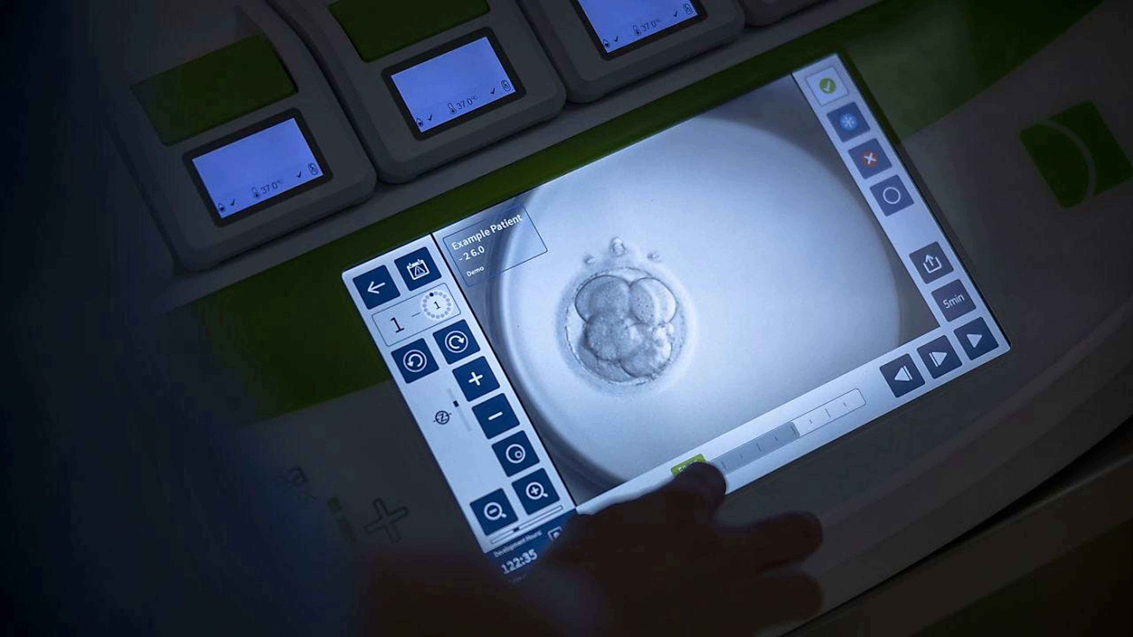 Actuellement en Suisse, seul le don de sperme est autorisé. A l'avenir, le don d'ovules devrait aussi l'être (image d'illustration).