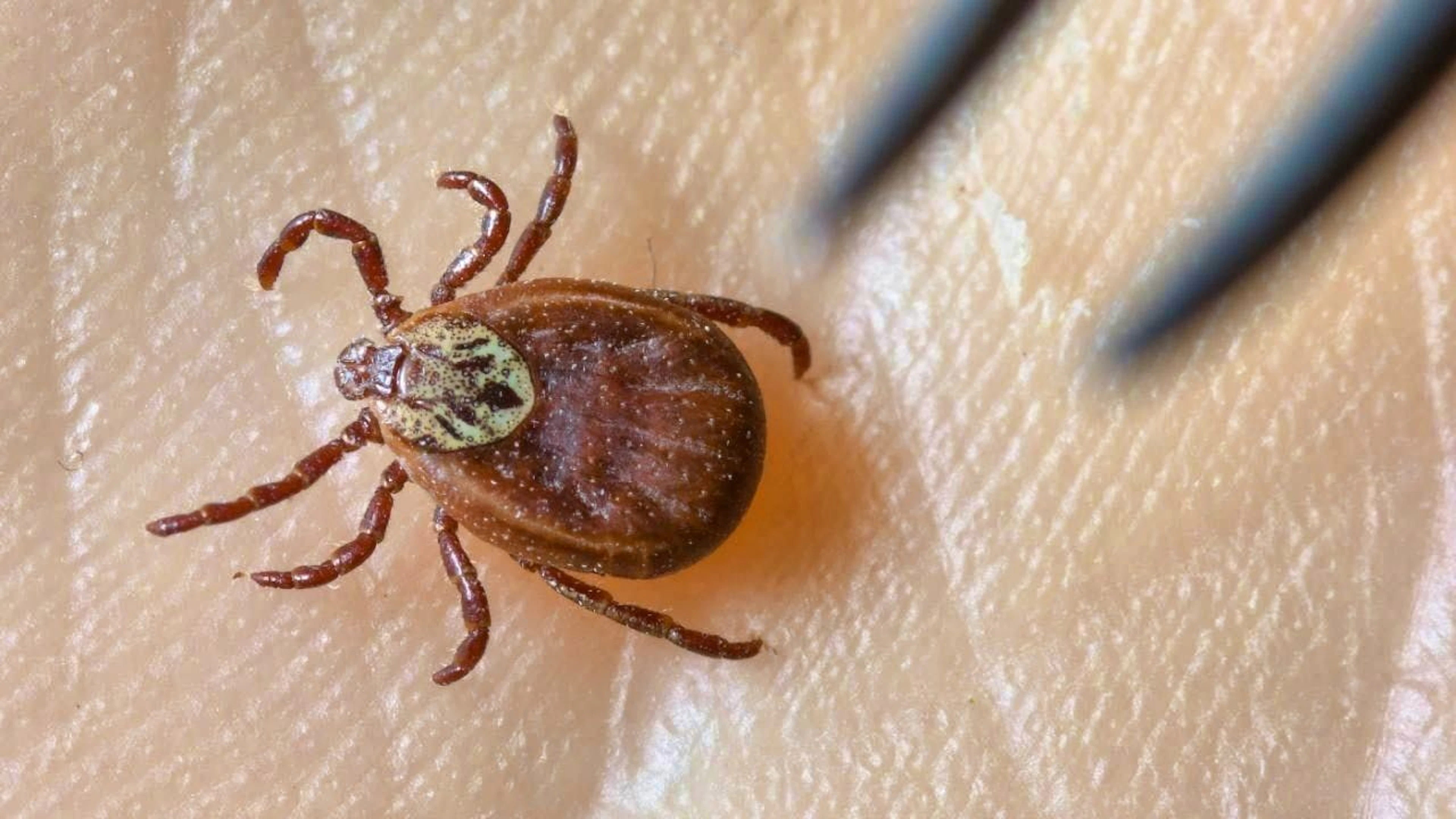 Tick bites are becoming increasingly common due to mild winters and longer warm periods.