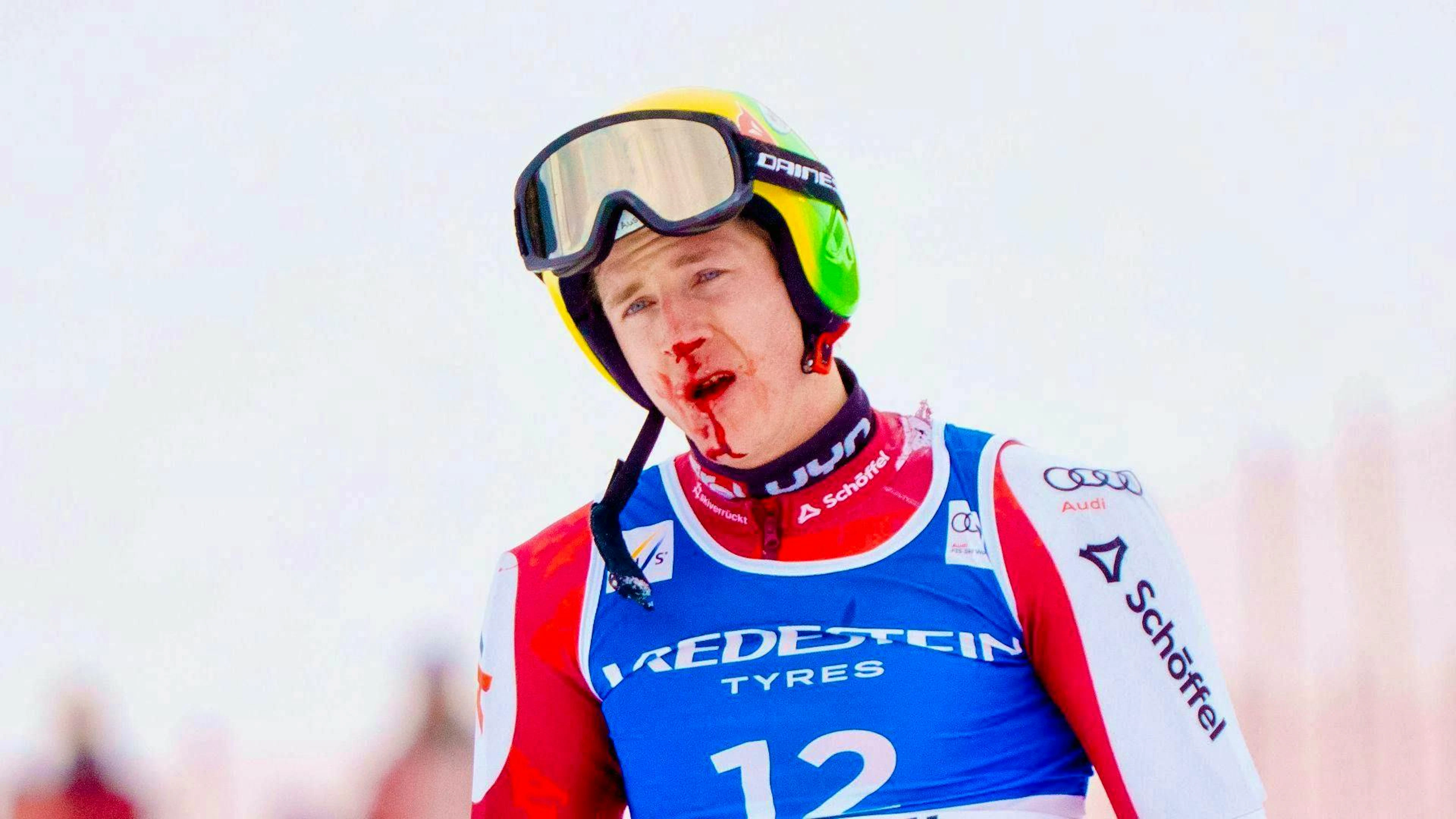 Raphael Haaser with a bloodied face after his fall.
