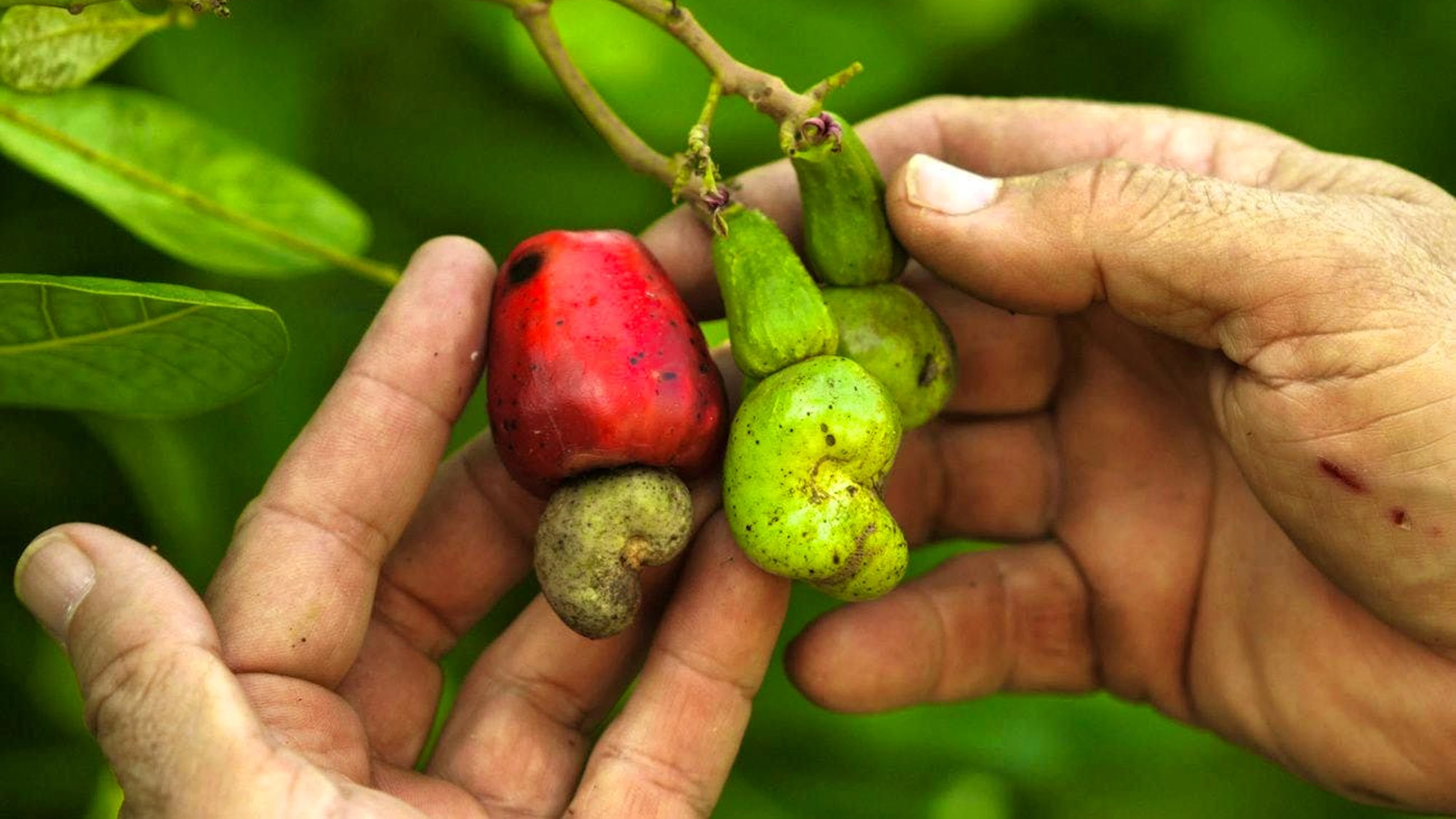 Cashew nuts are increasingly causing allergic reactions in children.