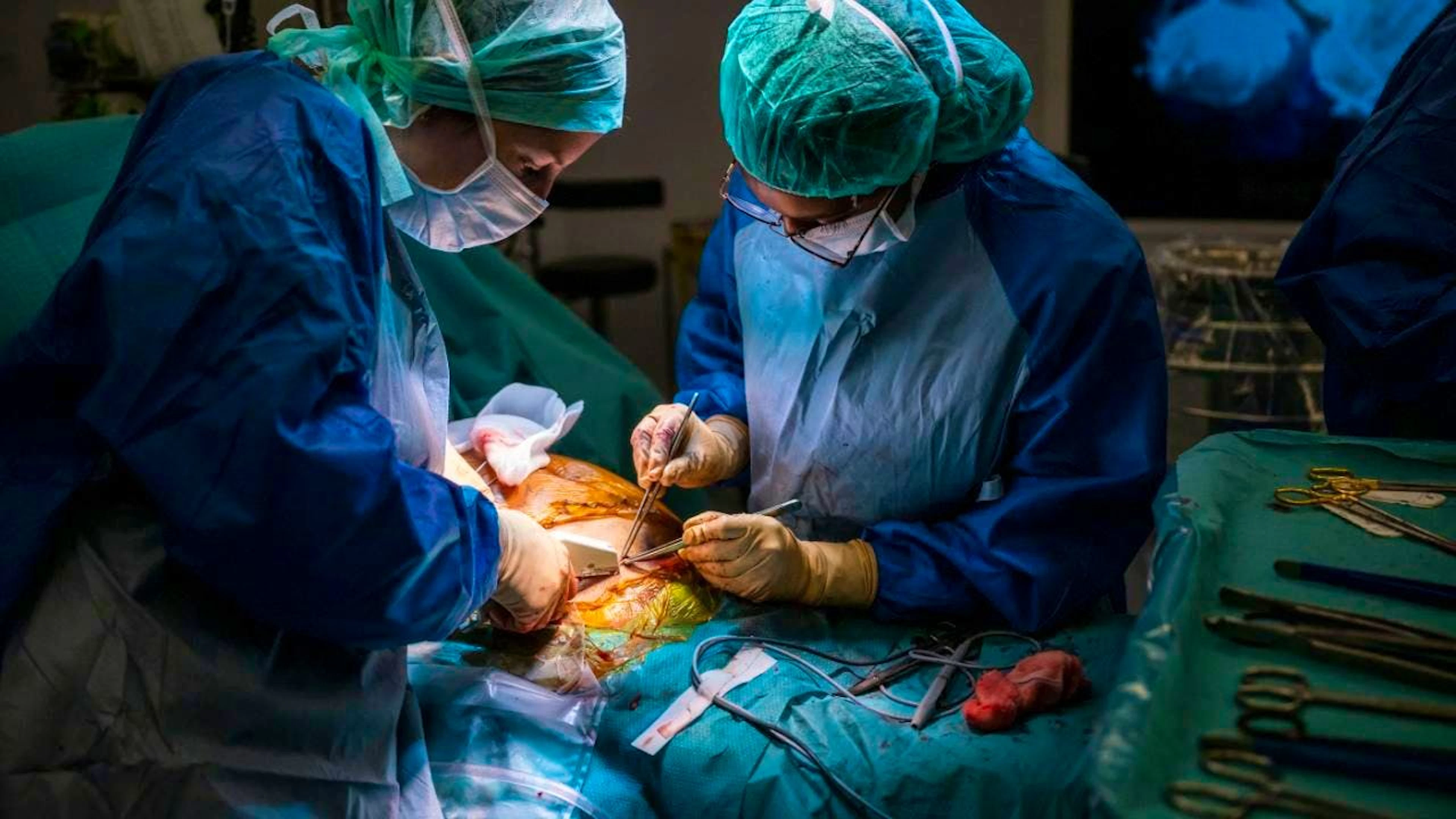 Mehr Organspenden von Verstorbenen, aber weniger Lebendspenden: So hat sich die Spendebereitschaft in 24 Ländern im Durchschnitt entwickelt, nachdem sie die sogenannte Widerspruchslösung eingeführt hatten. (Archivbild)