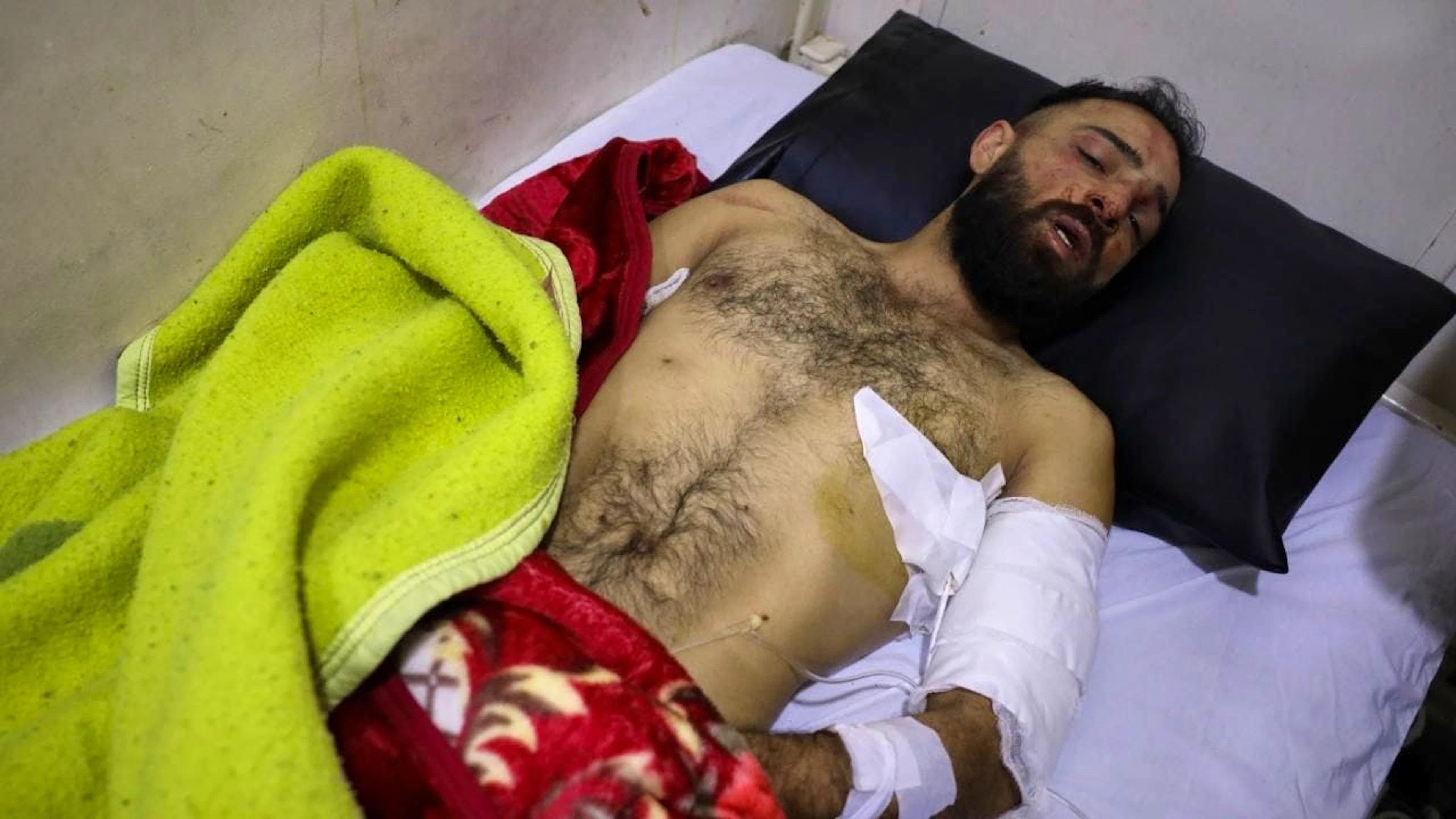 Un homme blessé dans les heurts entre Alaouites et contre-manifestants à l'hôpital.