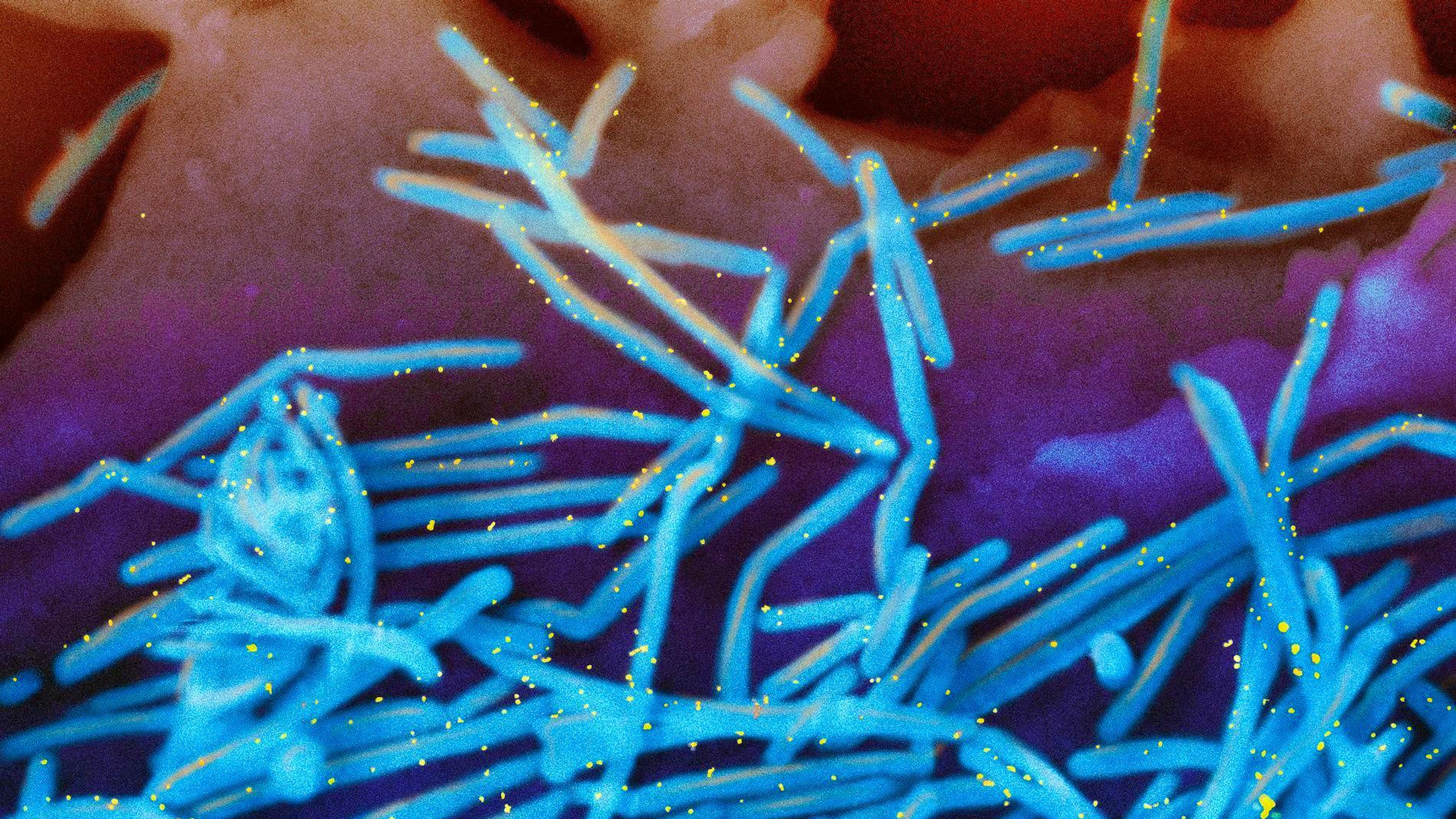 Respiratory syncytial virus (RSV) is an enveloped RNA virus that shows a thread-like (filamentous) to spherical structure under an electron microscope. It causes respiratory infections worldwide, especially in winter, and leads to the fusion of infected respiratory cells.