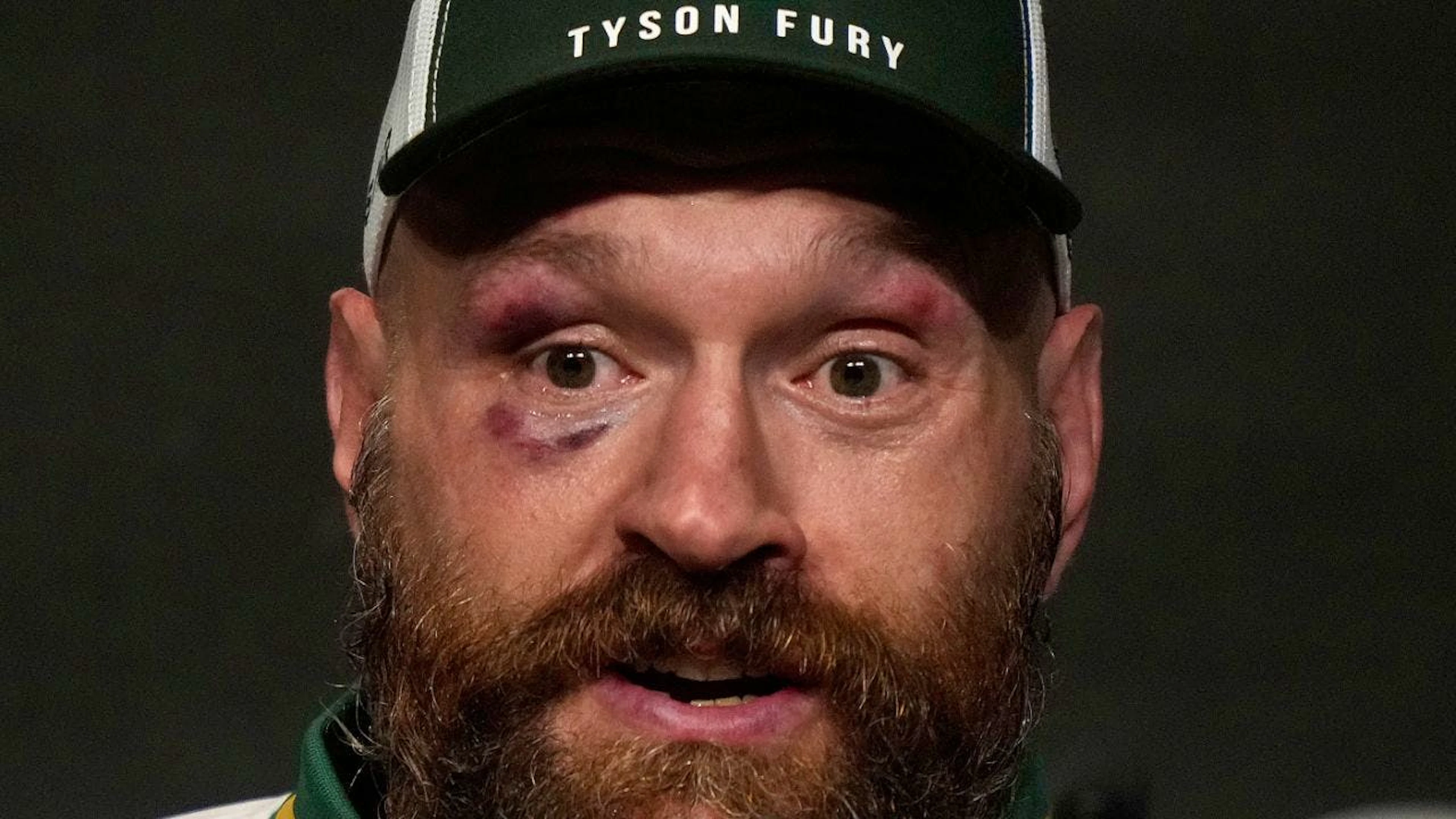 Tyson Fury a réussi son retour sur les rings