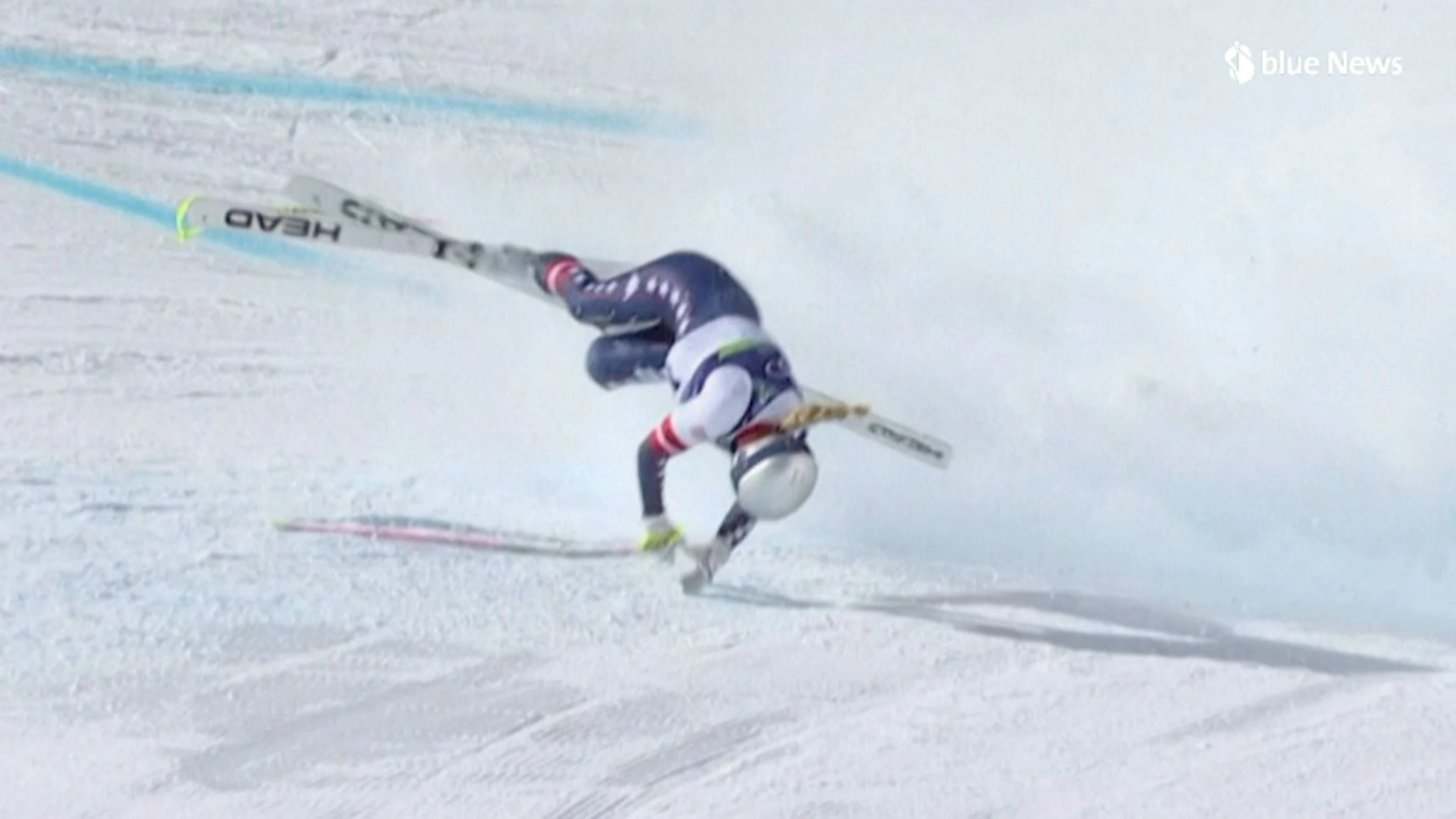 JO 2026 : Lindsey Vonn affirme que sa jambe a été «sauvée de l'amputation»