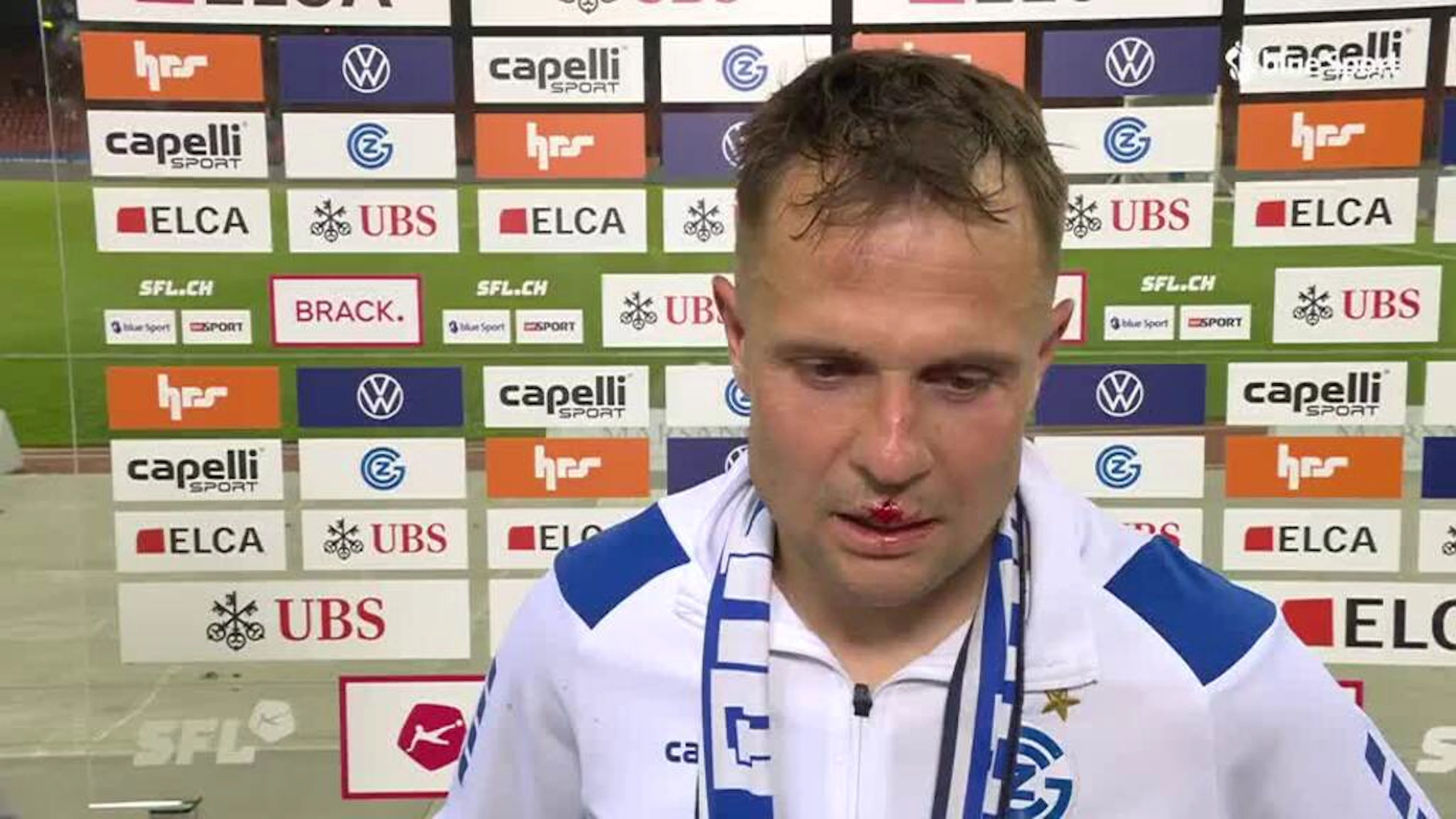 Abrashi: «Es ist nur eine Platzwunde, das hält mich nicht auf»