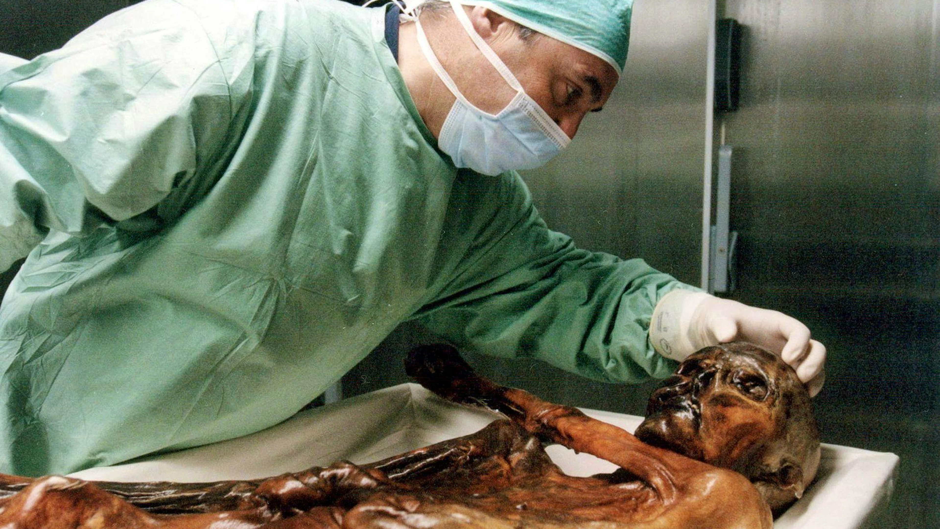Ein Wissenschaftler untersucht im Südtiroler Archäologiemuseum in Bozen, Italien, die Mumie des Steinzeitmannes «Ötzi».