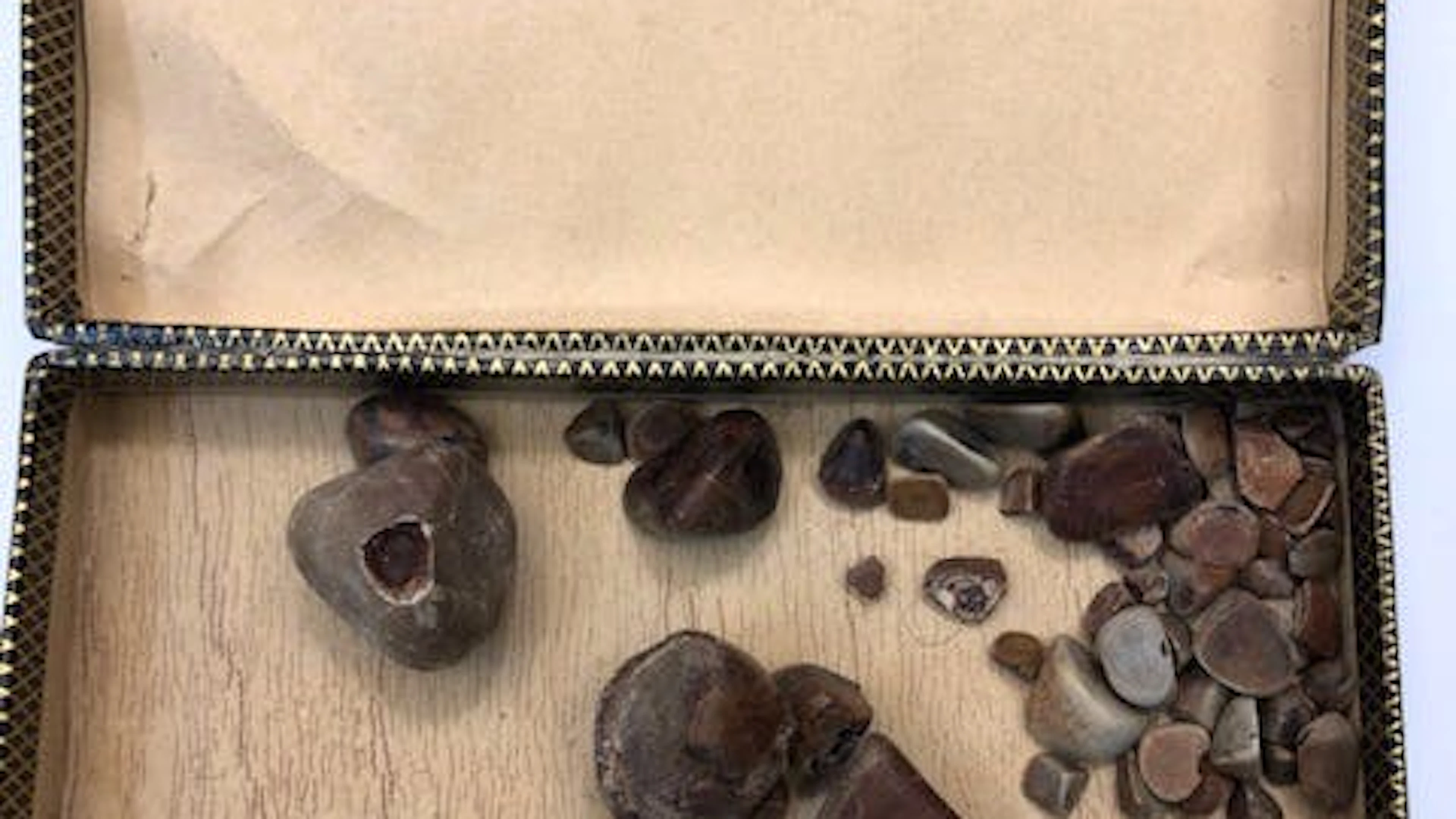 Omas Gallensteine von 1966