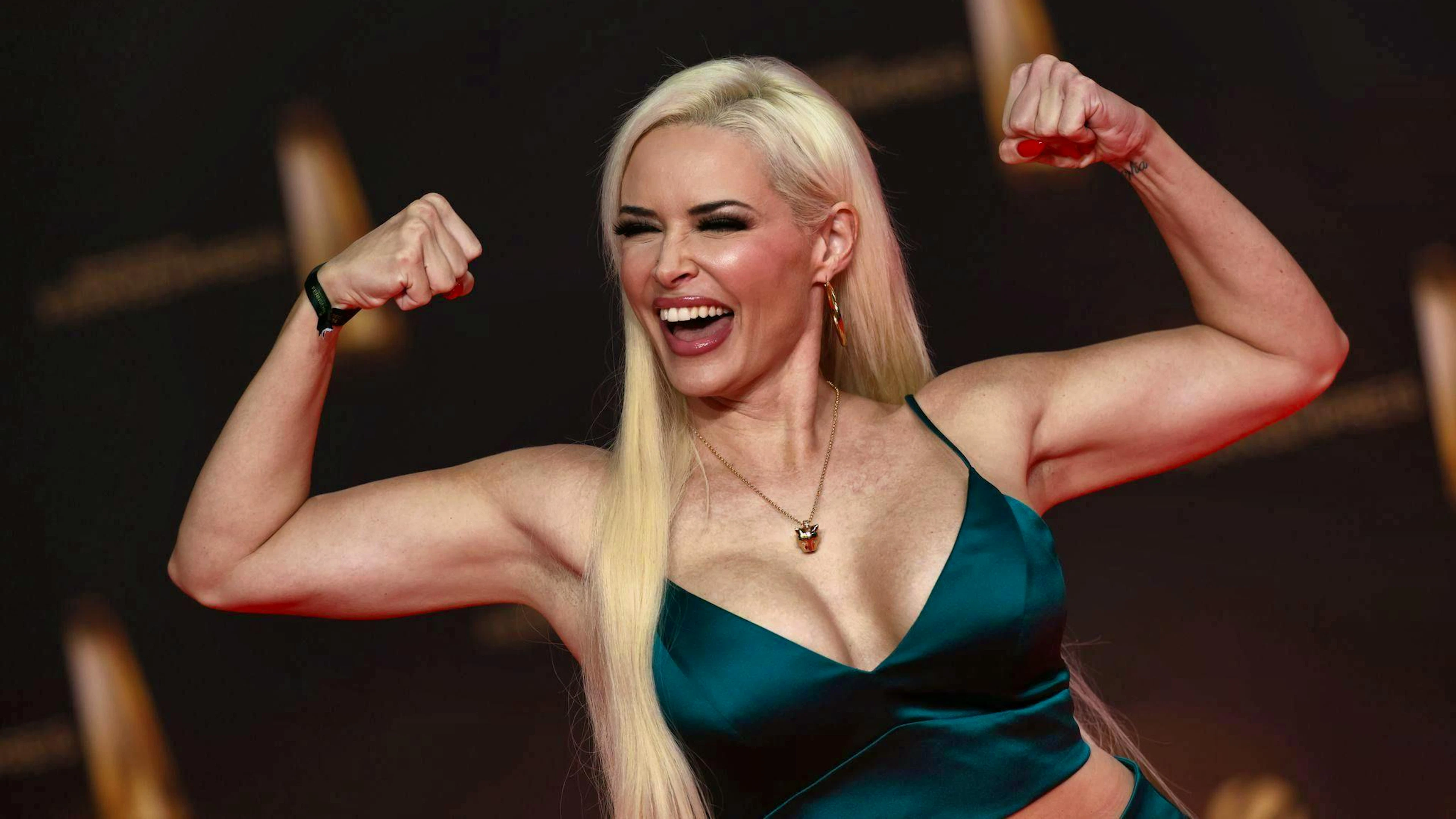 TV star Daniela Katzenberger has never made a secret of her cosmetic surgeries.
