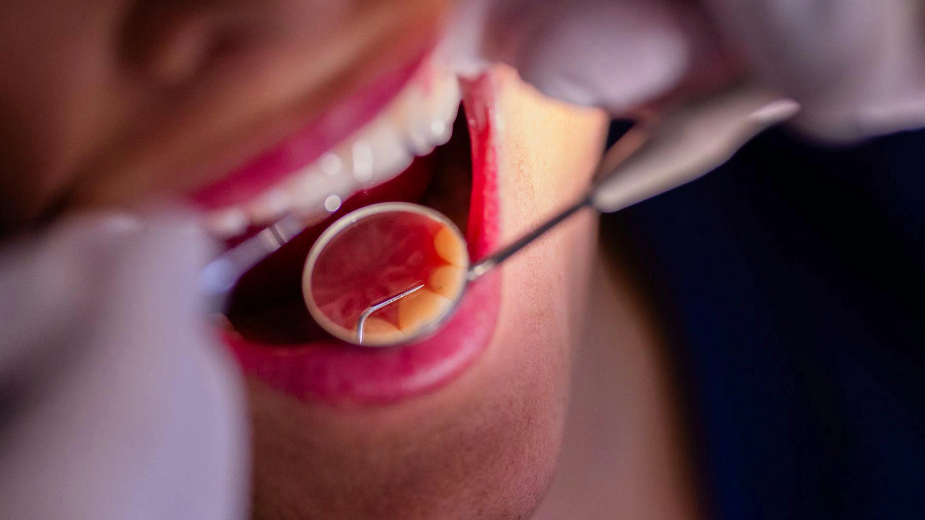 Il Ticino ha nettamente bocciato l'iniziativa per il rimborso delle cure dentarie (immagine illustrativa).