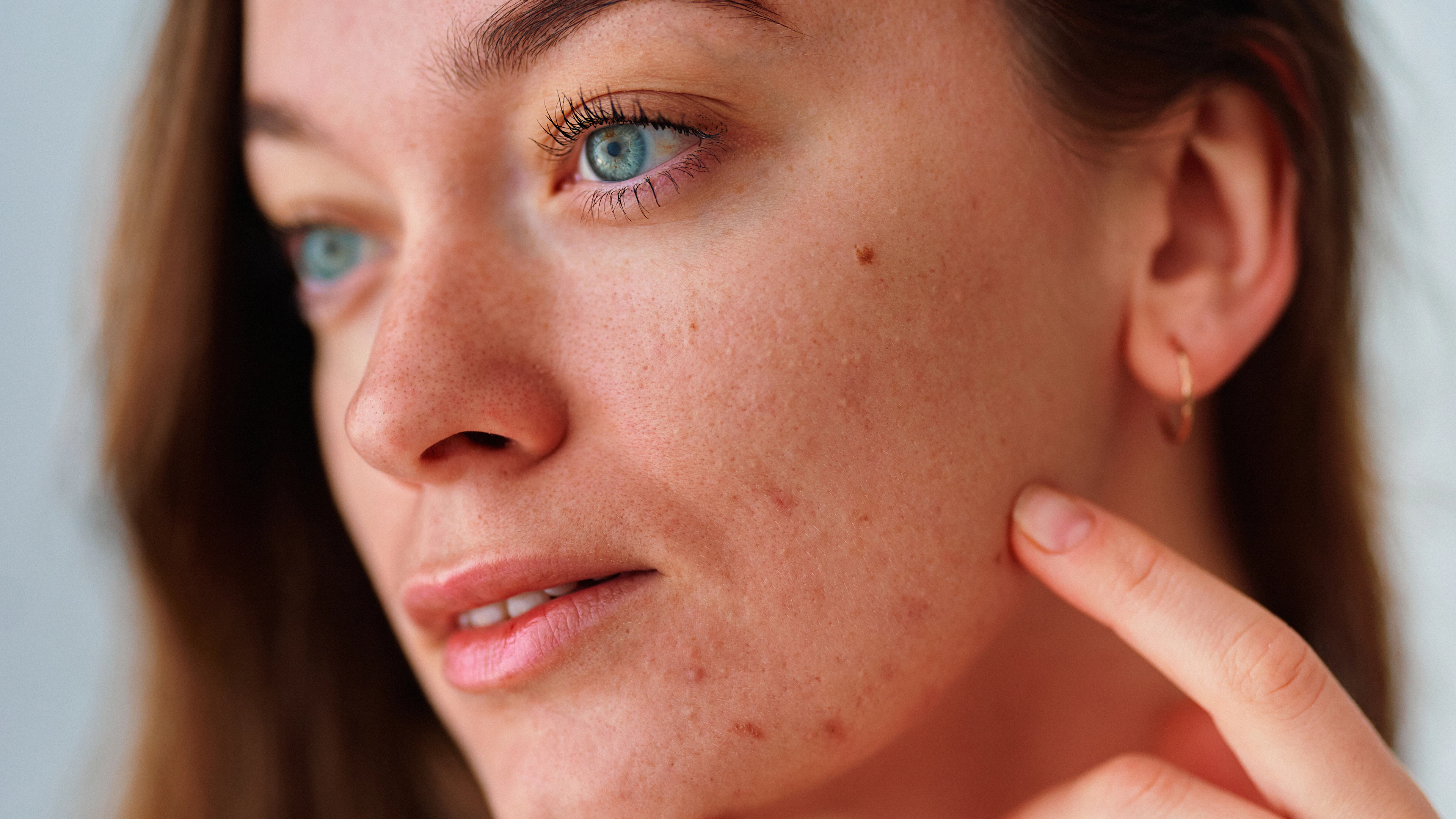 Votre peau révèle votre niveau de stress – les conseils d'une experte