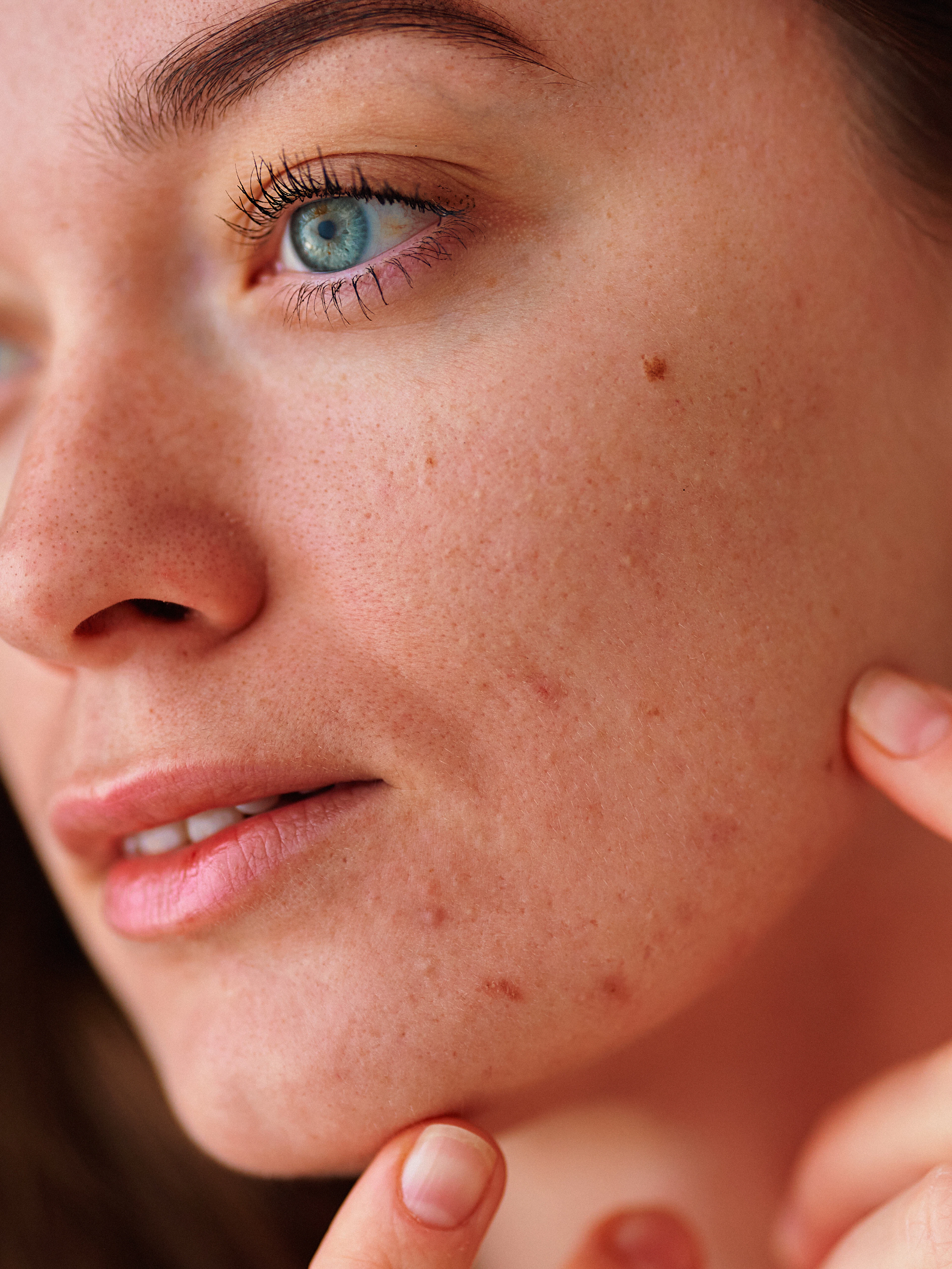 Votre peau révèle votre niveau de stress – les conseils d'une experte