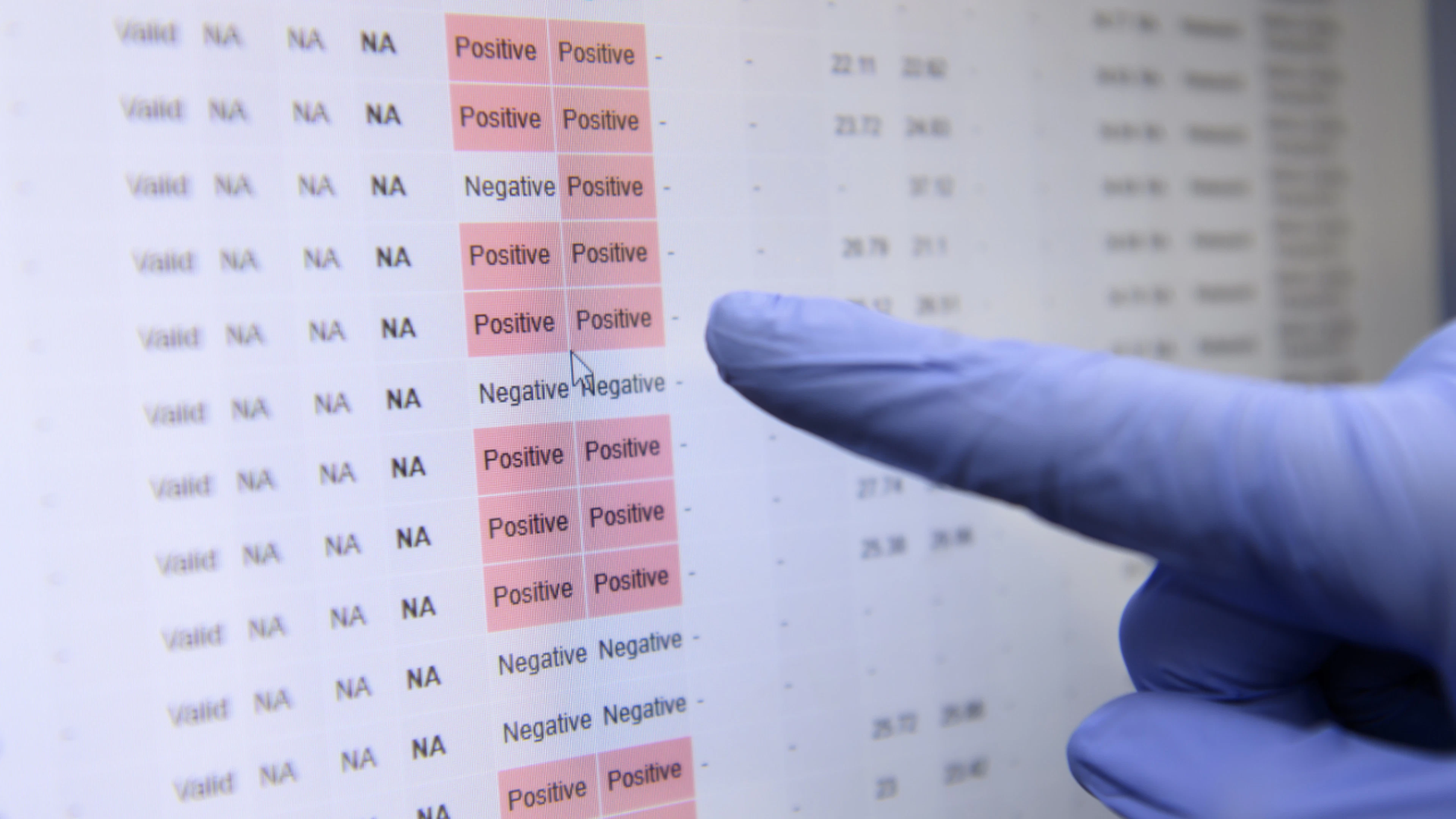 Roche: nuovo test più rapido per l'infezione da tubercolosi