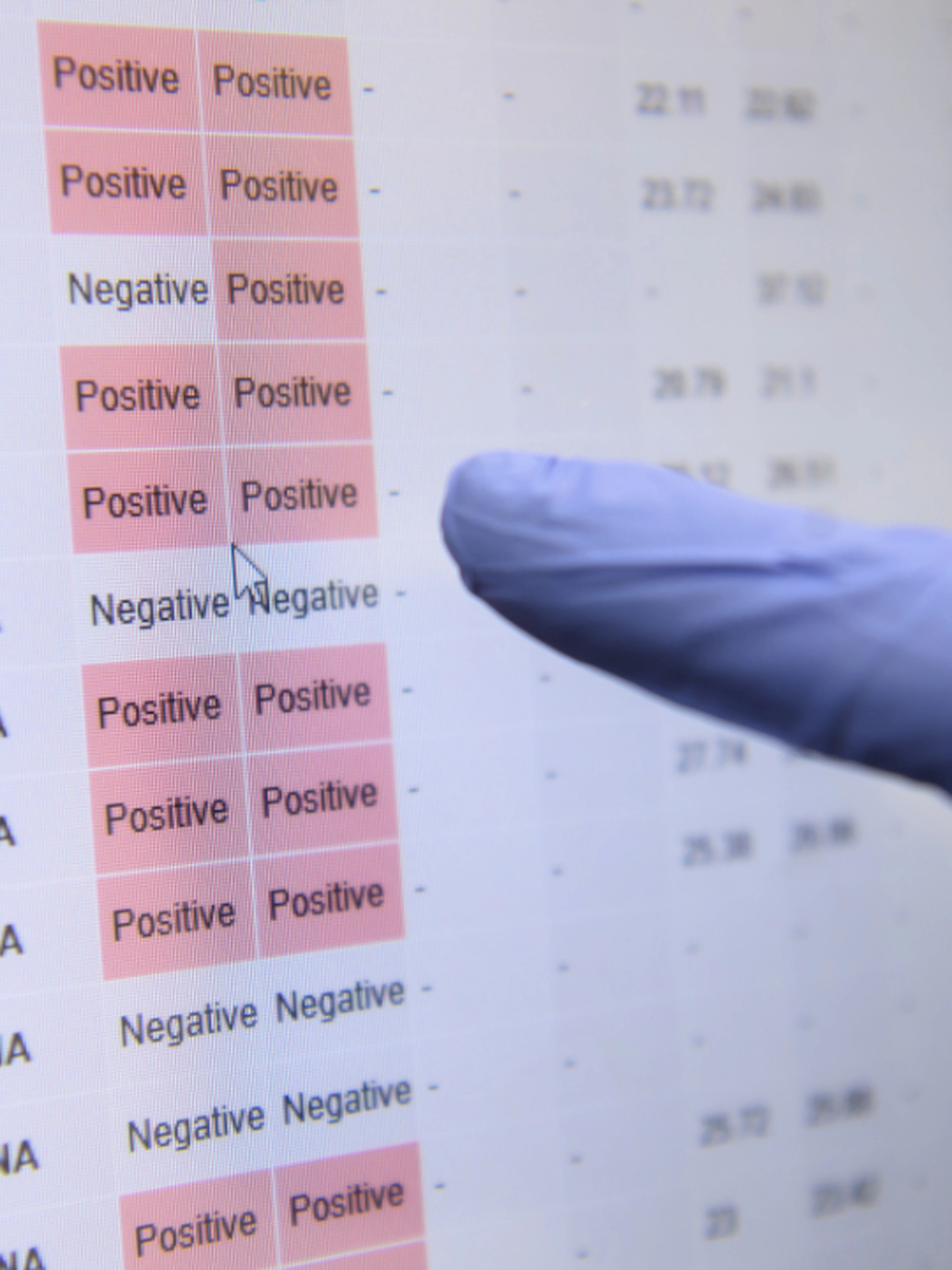 Roche: nuovo test più rapido per l'infezione da tubercolosi