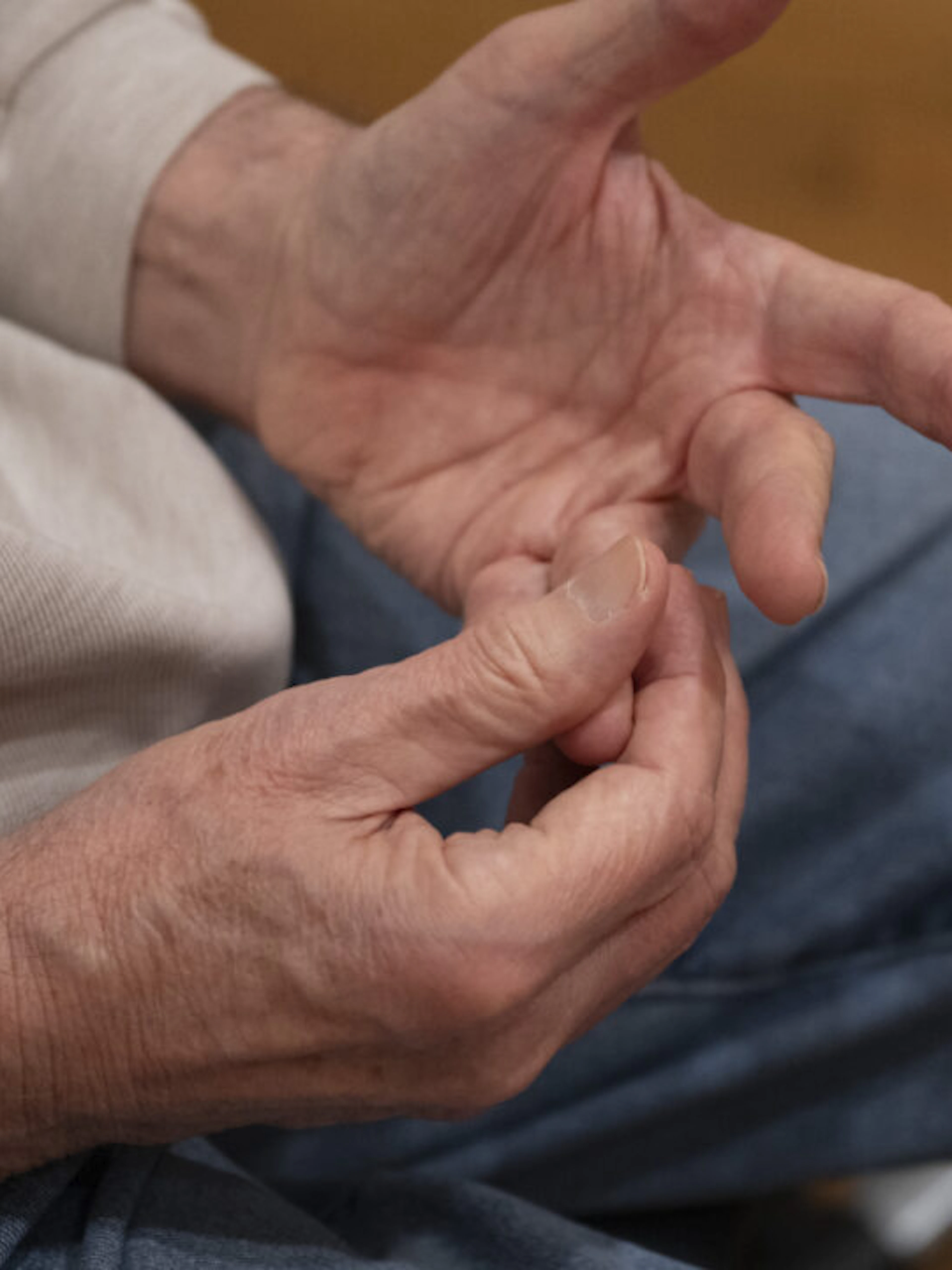 A 8 pazienti di Parkinson è stato fatto il primo trapianto di staminali nel cervello