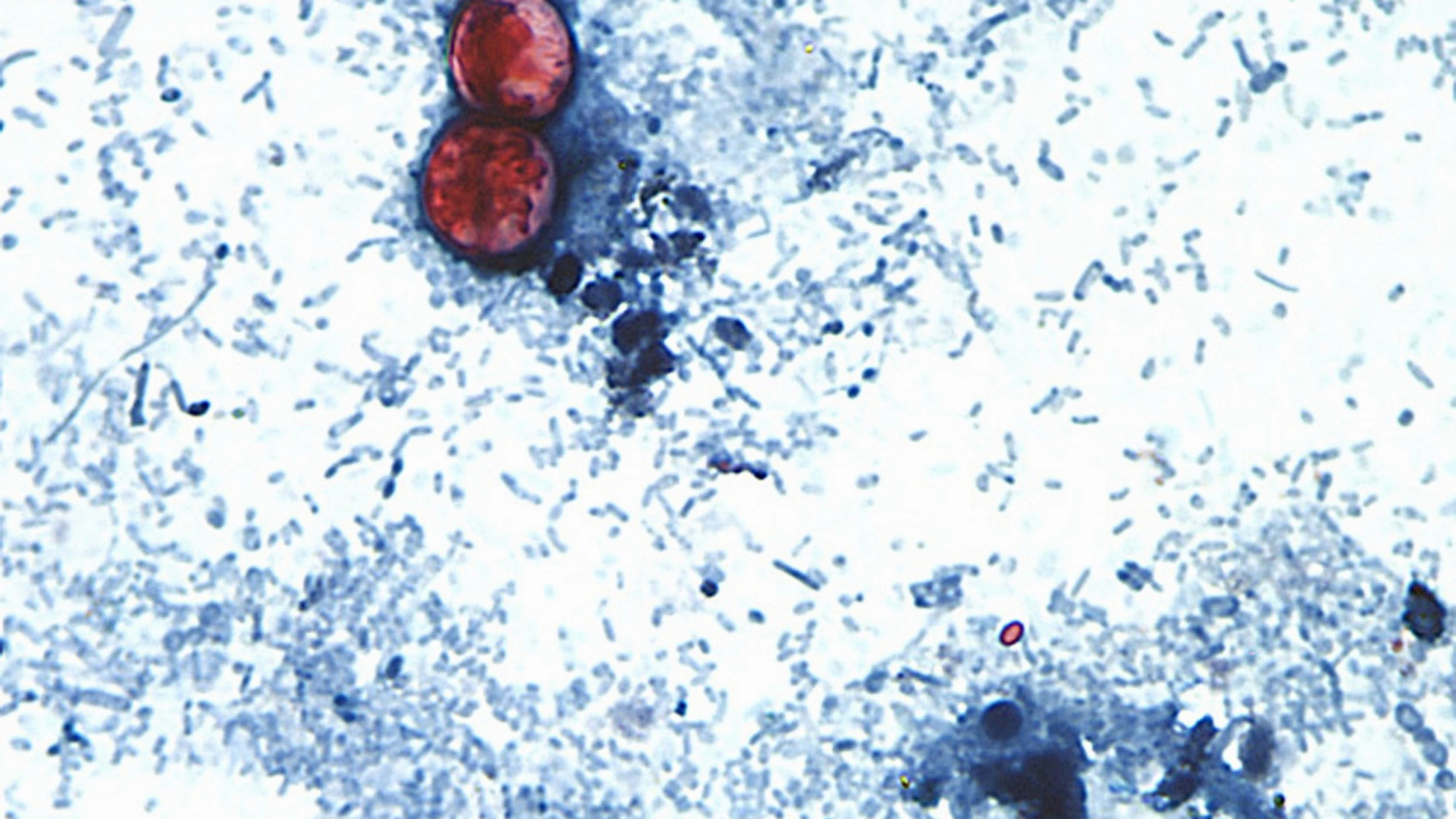 Ursprung für Durchfall-Parasiten in den USA weiterhin vollkommen unklar