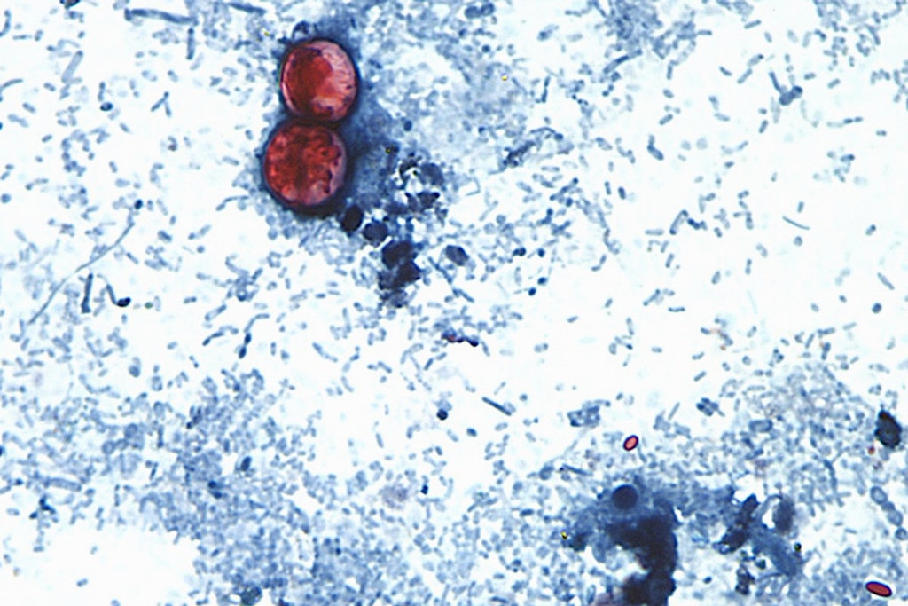 bluewin.ch - Two Dead in Parasite Outbreak in the U.S. - Hundreds Hospitalized