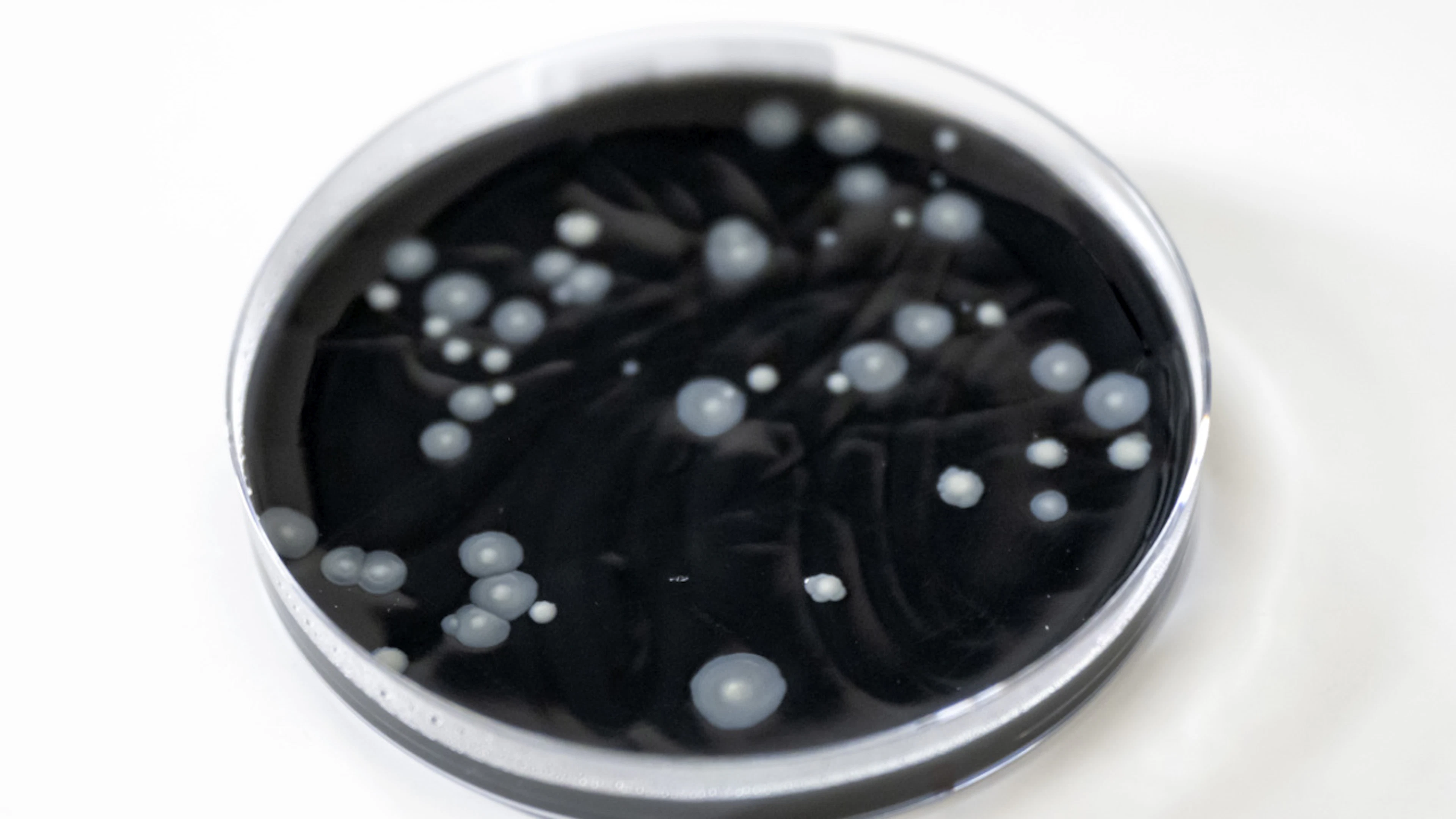 A cell culture containing Legionella bacteria at the Basel-Stadt Cantonal Laboratory. (File photo)