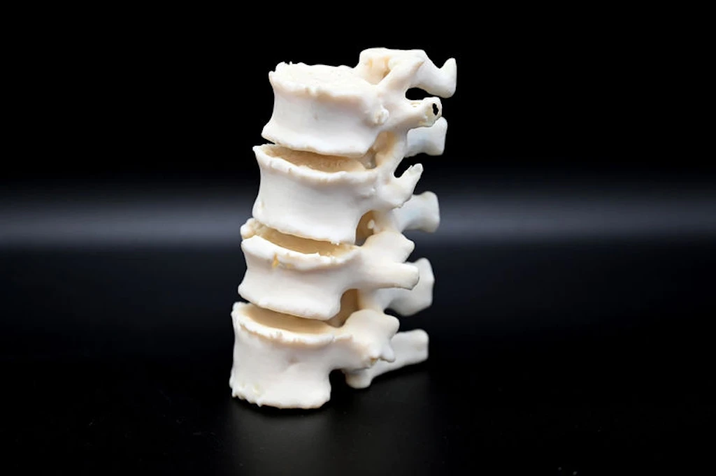 4.5 Million for a 3D Bone Printer — Lucerne Fraud Case to Be Reopened